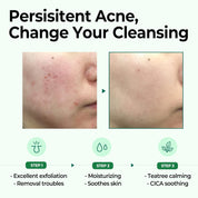 AHA BHA PHA 30 Days Miracle Cleansing Bar