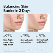 Amino Acid Ultra-Gentle Cleansing Mousse 100ml