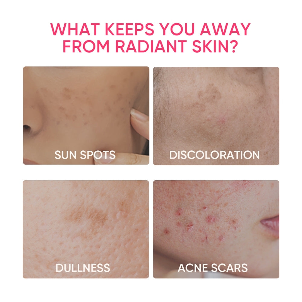 MSH Niacinamide Brightening Moisture Gel