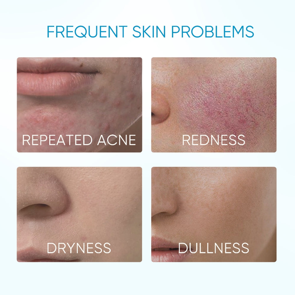 5X Ceramide Barrier Moisture Gel