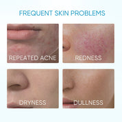 5X Ceramide Barrier Moisture Gel