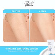 Vitamin E Whitening Lotion 200g