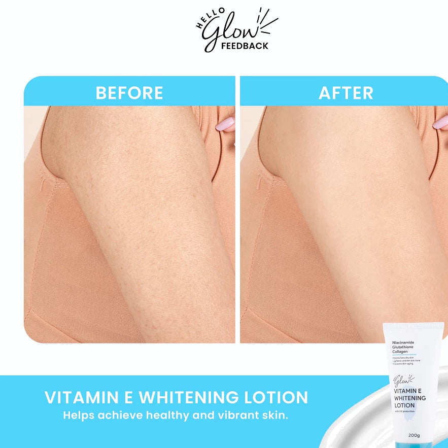 Vitamin E Whitening Lotion 200g