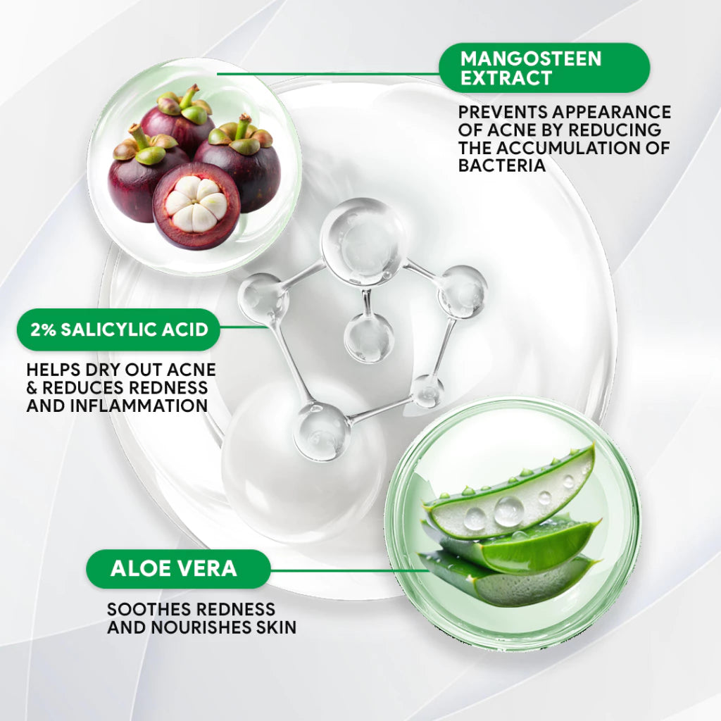 Facial Acne Lotion 10ml