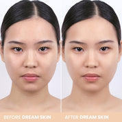 Dream Skin