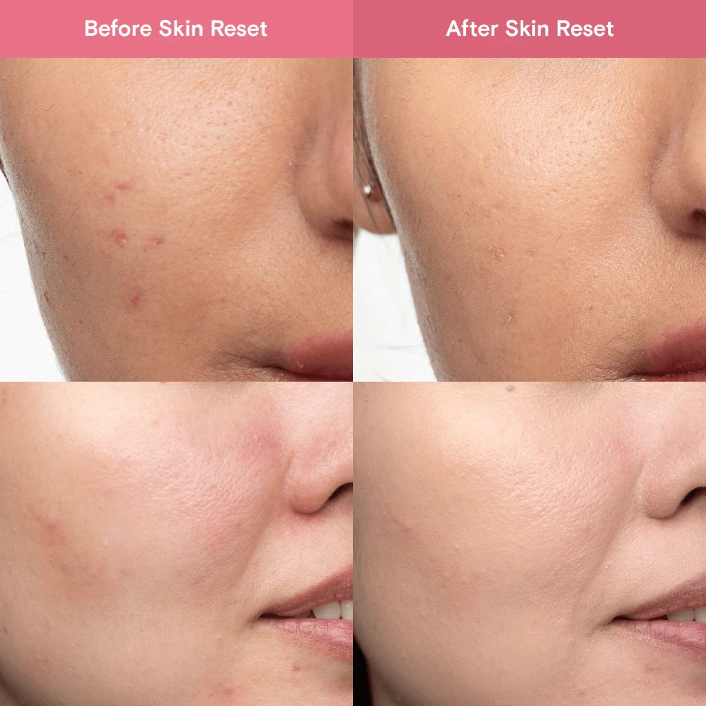 blk skin Redness Reducing Facial Spray Skin Reset