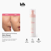 blk skin Redness Reducing Facial Spray Skin Reset