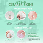 Pimple Warrior! Salicylic Acid Acne Drying Lotion 35g
