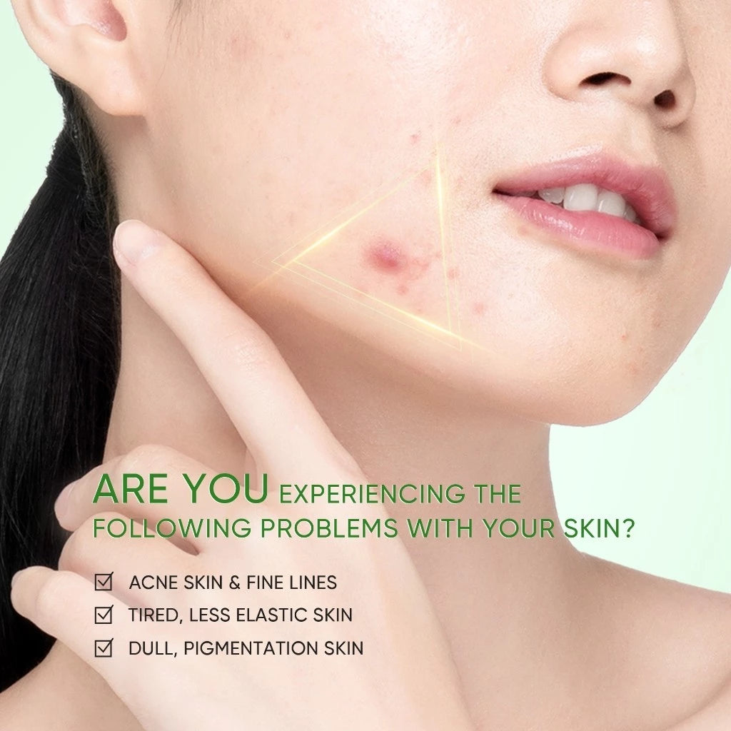 3X Acid Acne Gel Cleanser 120ml