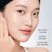 3X Acid Anti-Acne Gel Moisturizer 30g