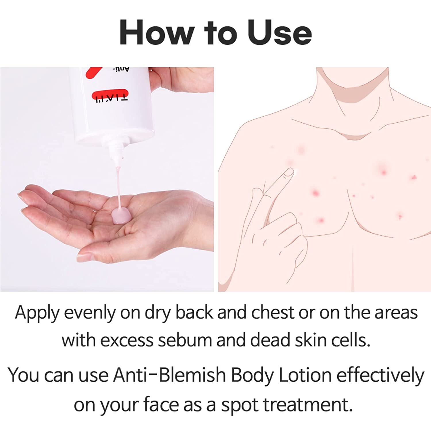 Anti-Blemish Body Lotion 200ml