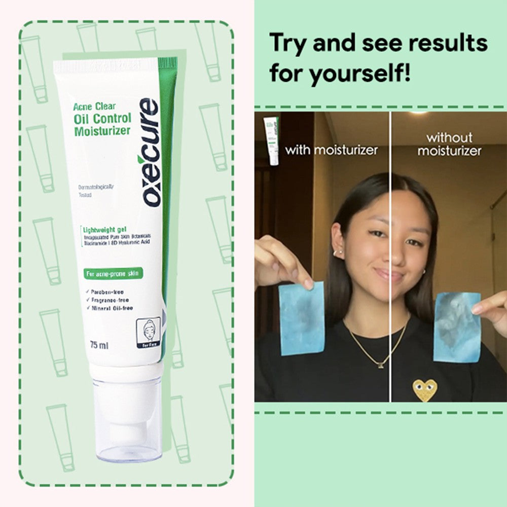 Acne Clear Oil Control Moisturizer 75ml