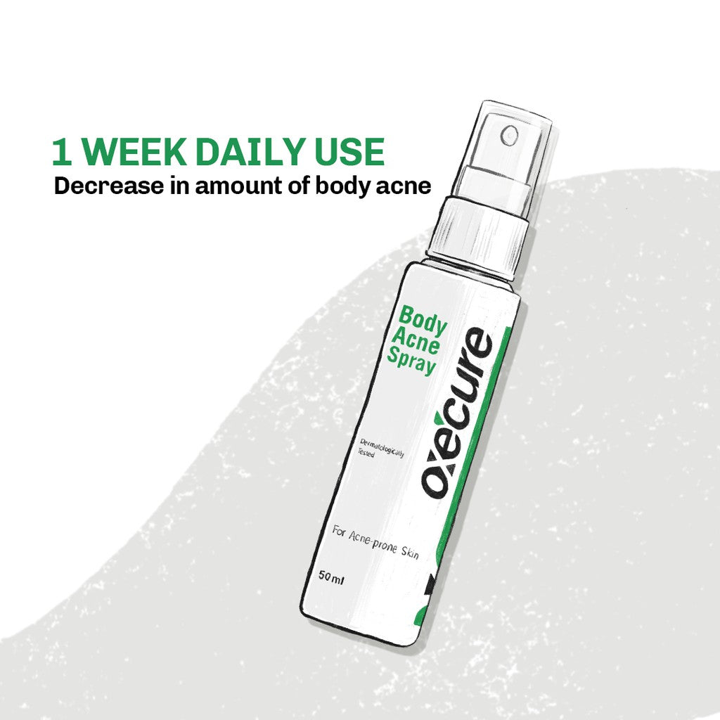 Body Acne Spray 50ml